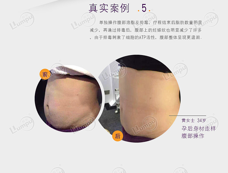 主图 车图 海报图  banner 美容行业 美容仪器 详情页