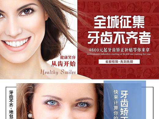 牙齿矫正banner