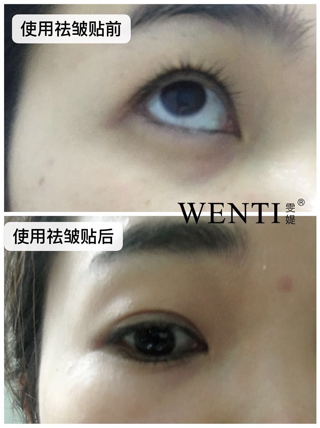 一颗向上的心|不该有下坠的皱纹|去皱贴实拍后期修图（图ZMTUzMTk4Mjg0） - 品牌 - 站酷设计师墨小先生原创素材 - 站酷ZCOOL