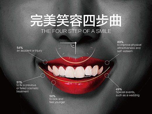 维乐口腔dsd微笑美学设计