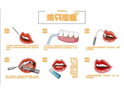 洗牙流程图