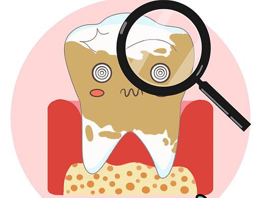 超声波洗牙流程