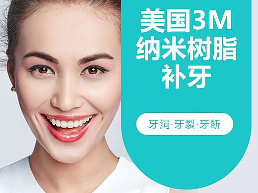 3m树脂补牙