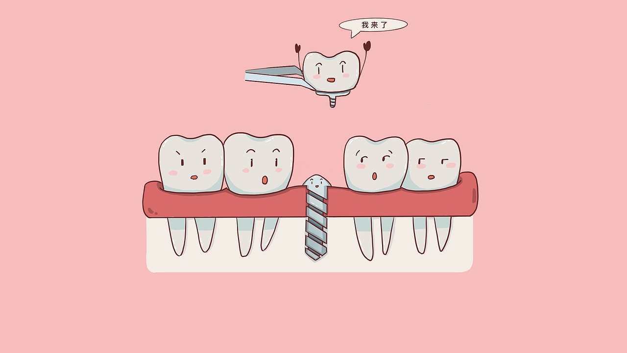 种牙流程（图ZMTgyNzEzNjc2） - 创作习作 - 站酷设计师刘玉美口腔插画原创素材 - 站酷ZCOOL
