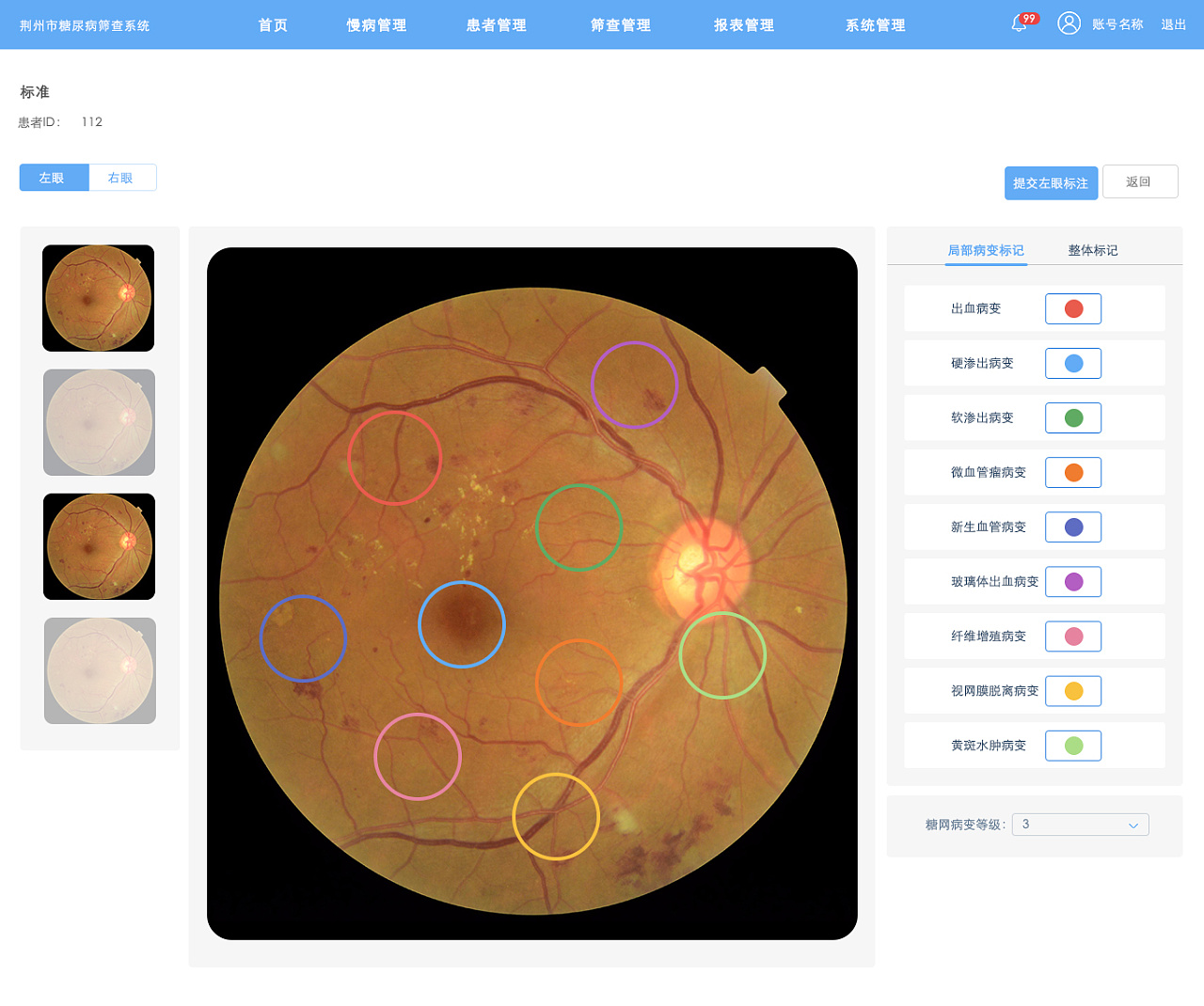 医疗眼底镜部分