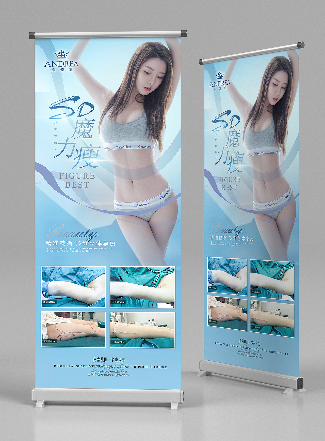 整形医美项目案例展架美容品项易拉宝吸脂面雕抗衰海报