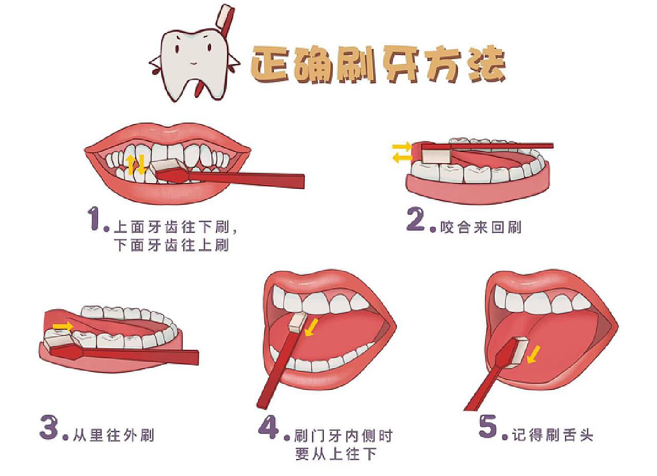日常口腔护理——刷牙的正确姿势！ | 升艺口腔医院
