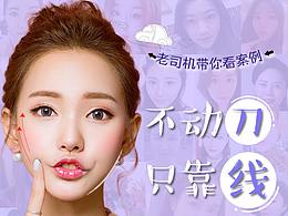 线雕