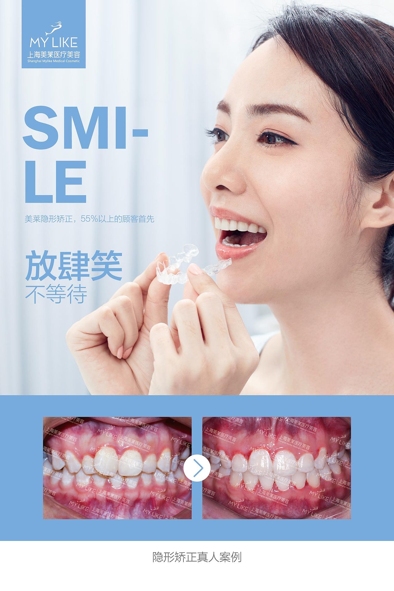 口腔灯箱片海报|平面|海报|囹囹 - 原创作品 - 站酷 (zcool)