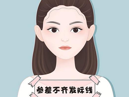 发际线