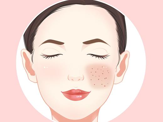 热玛吉（个人主页-ZNDkwNjc4ODg=） - 创作习作 - 站酷设计师浅野先生丶原创素材 - 站酷ZCOOL