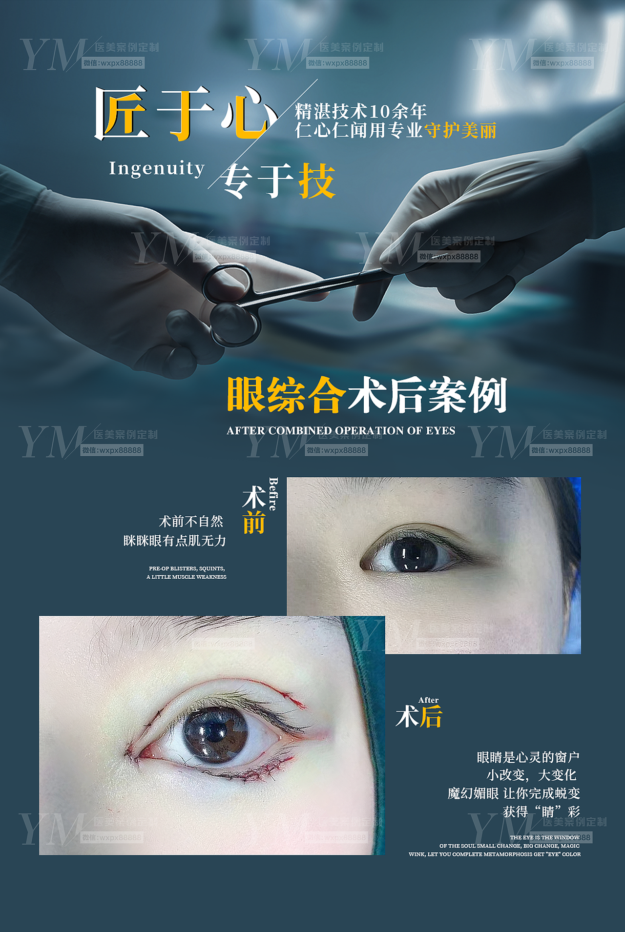 医美案例对比图（图ZMjQxMDU4NzI4） - 其他平面 - 站酷设计师艺美星球原创素材 - 站酷ZCOOL