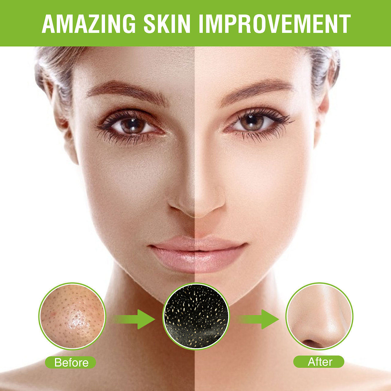 去黑头面膜五件套主图|平面|海报|chesterfied - 原创作品 - 站酷