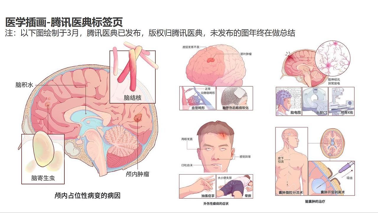 2021年中總結(jié)-下半年希望成為更優(yōu)秀的醫(yī)學(xué)插畫師（圖ZMjYxMjU4MzA0） - 商業(yè)插畫 - 站酷設(shè)計(jì)師sunny科研插畫原創(chuàng)素材 - 站酷ZCOOL