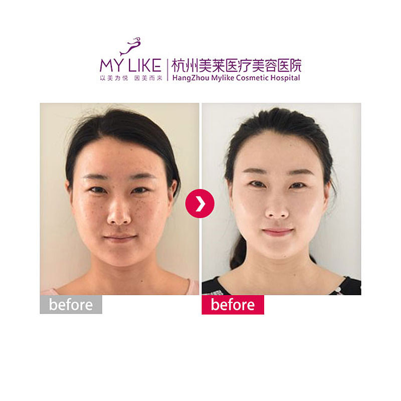 平台入驻主图（图ZMTM5MjIwMTQ0） - 电商 - 站酷设计师问问不会问你问题原创素材 - 站酷ZCOOL