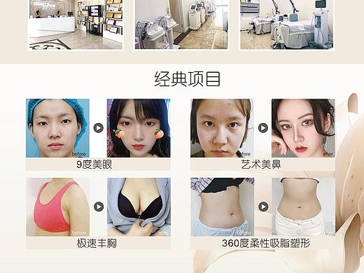 渠道物料