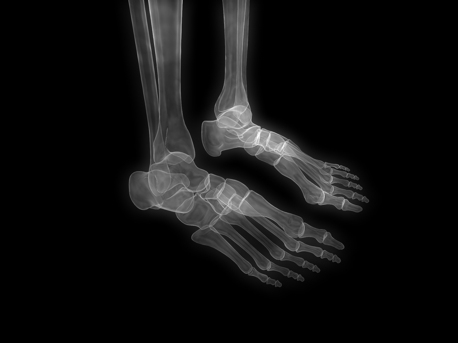 人类脚部骨骼的x光片。人体关节解剖x射线矢量图。插画图片素材_ID:423627868-Veer图库