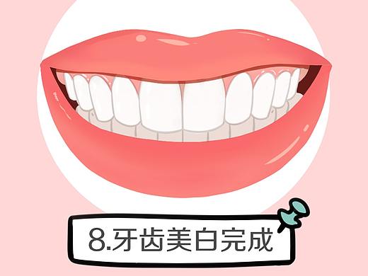 牙齿美白过程
