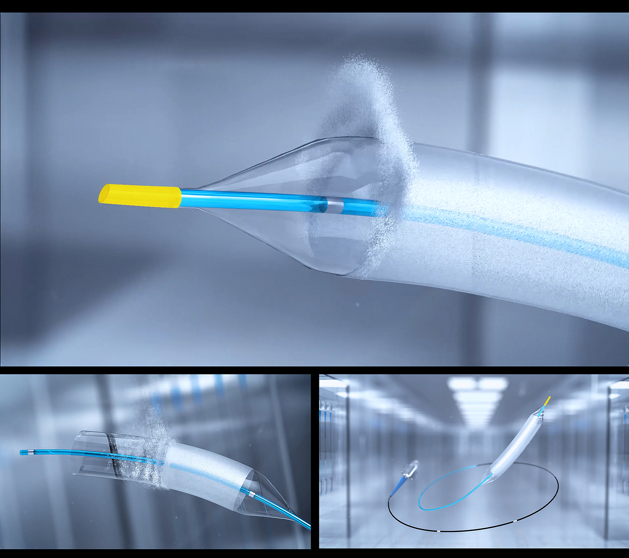 申淇医疗药物球囊动态设计