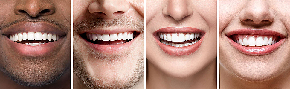 牙贴主图 A+（图ZMzMxMDAzNzky） - 电商 - 站酷设计师精奇设计原创素材 - 站酷ZCOOL