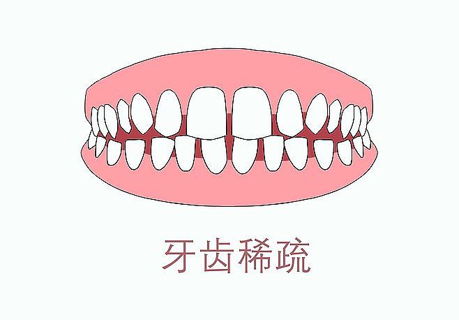牙齿，口腔，牙齿矫正，龅牙，虎牙，牙齿不齐（图ZMTgyODgyMzQ0） - 创作习作 - 站酷设计师没事画画哦原创素材 - 站酷ZCOOL