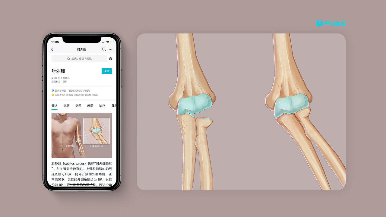 2020腾讯医典医学插画作品集（图ZMjM2OTEyNzQ4） - 艺术插画 - 站酷设计师不当咸鱼的咸鱼原创素材 - 站酷ZCOOL