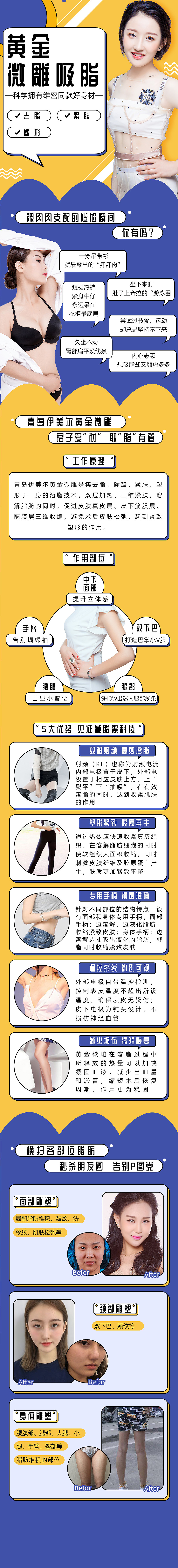 黄金单部位吸脂/酷塑冷冻溶脂