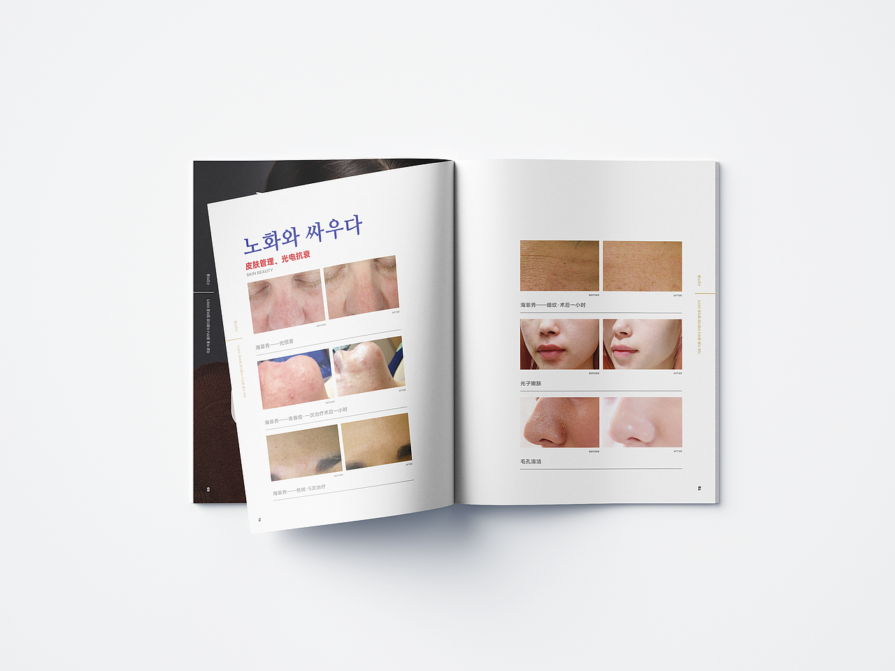 医美画册（图ZMzEzNjgxOTEy） - 书籍/画册 - 站酷设计师jack__原创素材 - 站酷ZCOOL