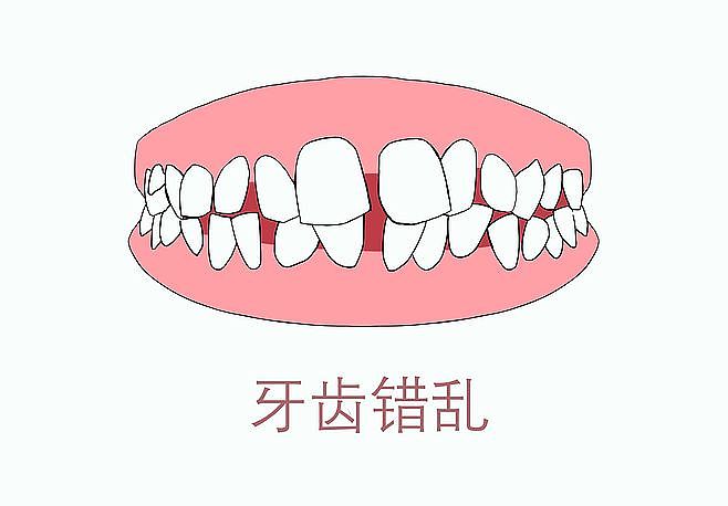 牙齿，口腔，牙齿矫正，龅牙，虎牙，牙齿不齐（图ZMTgyODgyMzY0） - 创作习作 - 站酷设计师没事画画哦原创素材 - 站酷ZCOOL