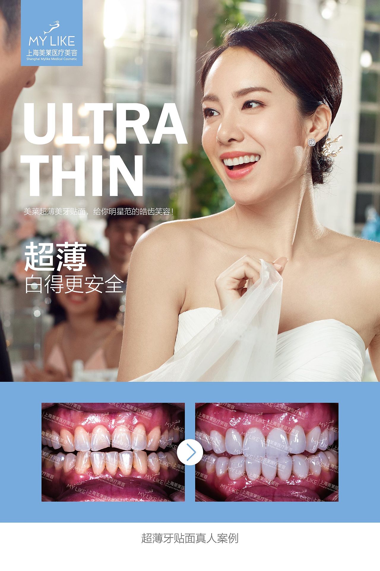 口腔灯箱片海报|平面|海报|囹囹 - 原创作品 - 站酷 (zcool)