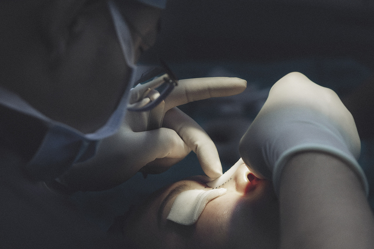 整形手术室里的故事 (壹)