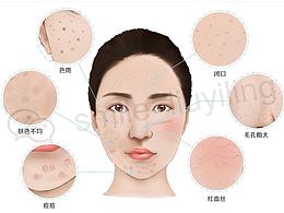 皮膚原理圖/剖面圖