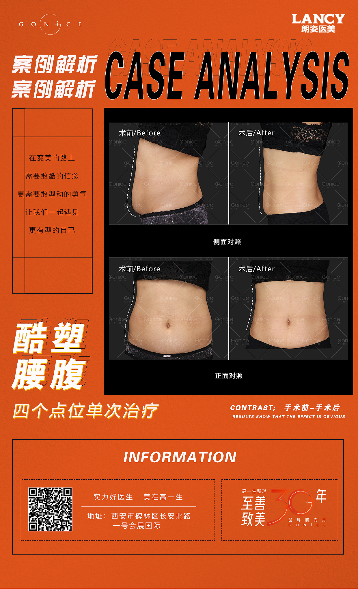 医美（图ZMjYzNjI0MzY4） - 海报 - 站酷设计师优姬988原创素材 - 站酷ZCOOL