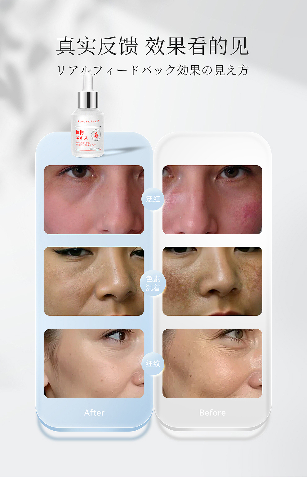 护肤品-植萃美肌精华/详情页设计