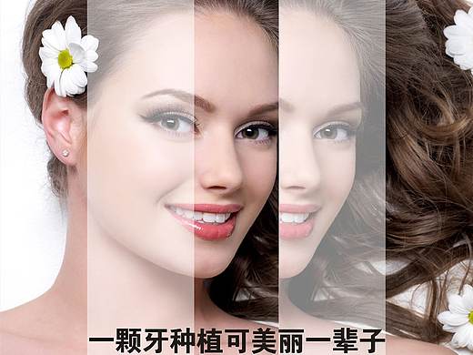 牙科广告画