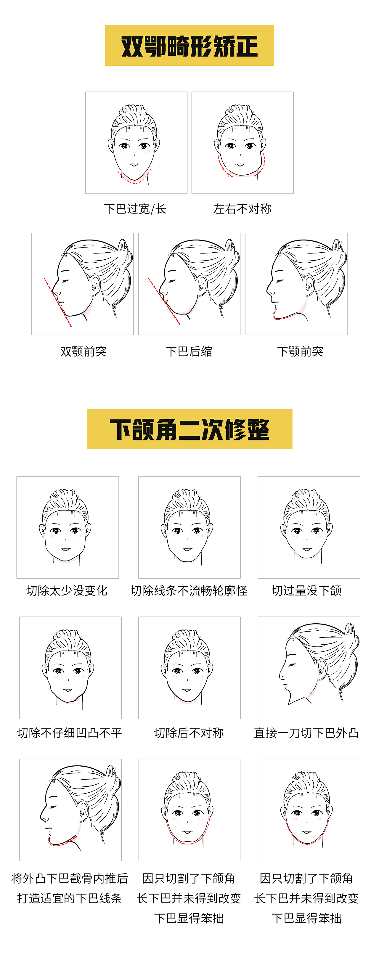 医美整形人物头部手绘（图ZMjgzNzg4NTU2） - 商业插画 - 站酷设计师狗被被原创素材 - 站酷ZCOOL