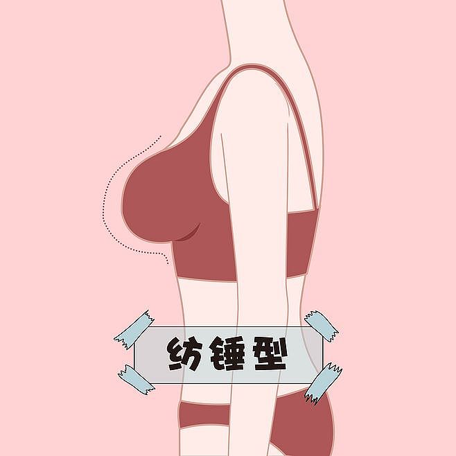 医美胸部胸型