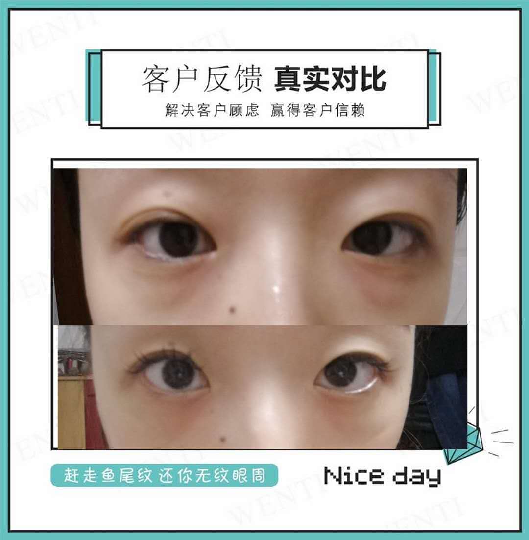 一颗向上的心|不该有下坠的皱纹|雯媞去皱贴|雯媞魔贴（图ZMTUxMjA3MjA4） - 品牌 - 站酷设计师墨小先生原创素材 - 站酷ZCOOL