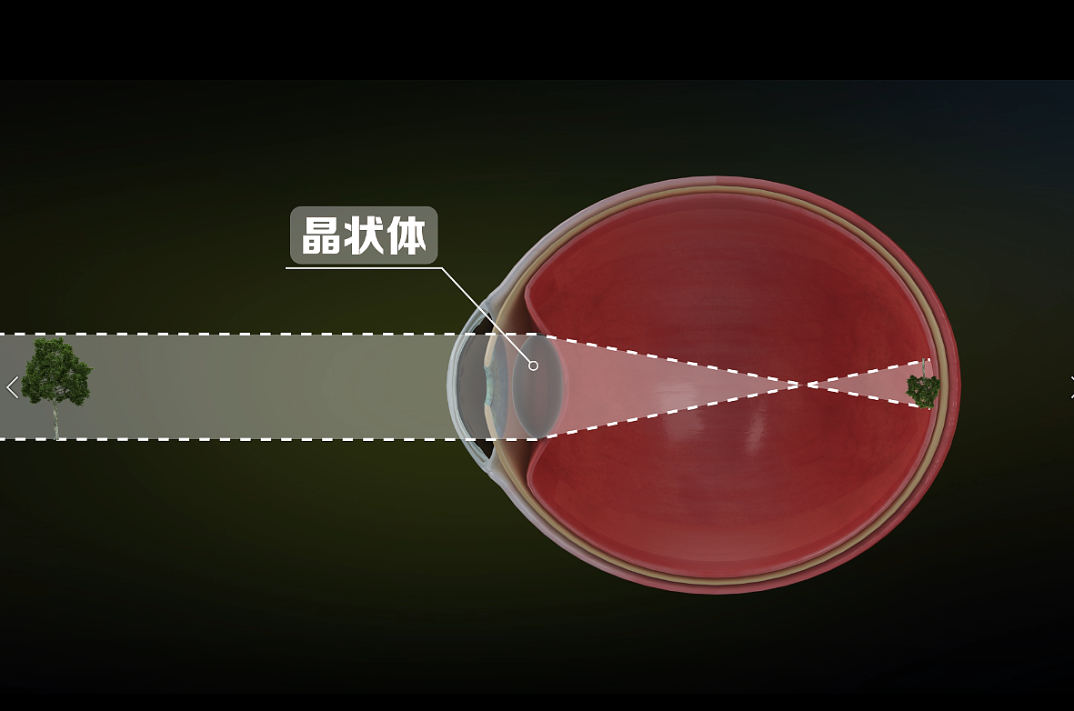 生物学-眼的散光|影视|影视后期|坤兮 - 原创作品 - 站酷 (zcool)