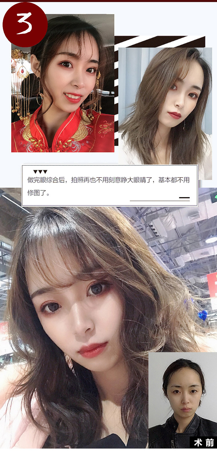 新氧新版详情页（图ZMTU4MDIwMzY4） - 海报 - 站酷设计师叫我小可乐吧原创素材 - 站酷ZCOOL