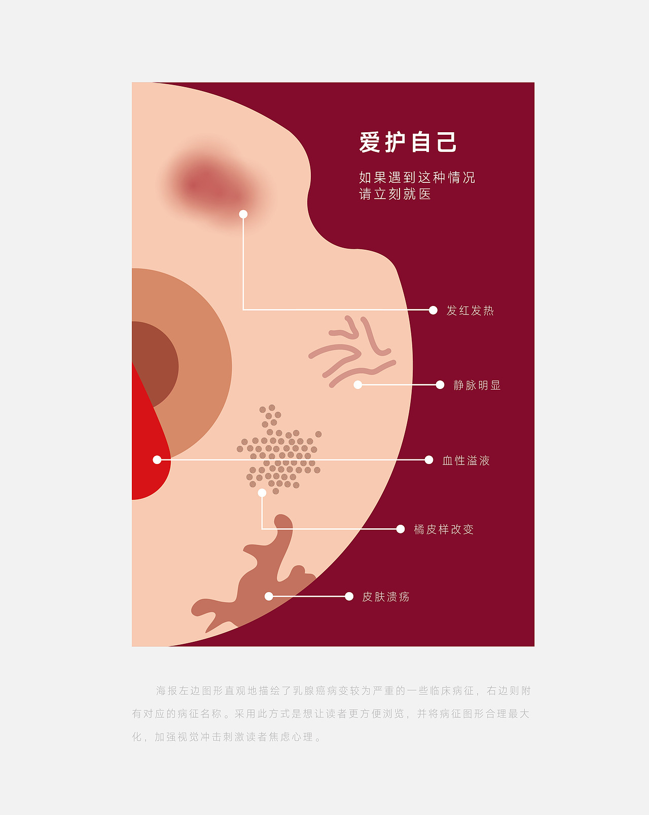公益海报:乳腺癌《爱护自己》