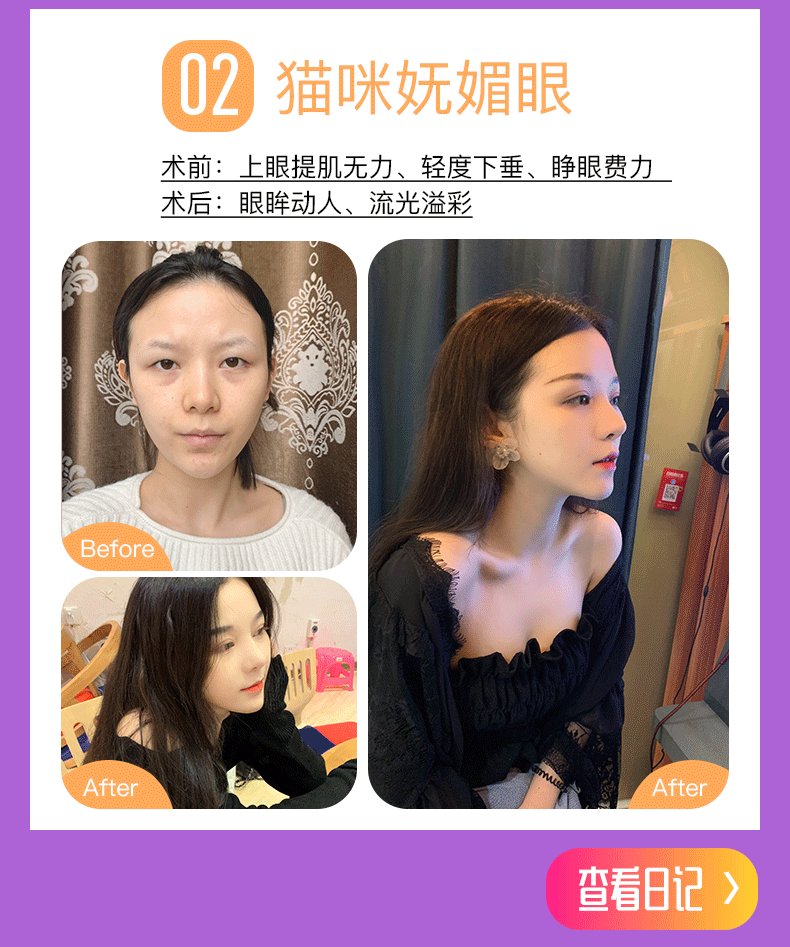 医美详情页——张霞飞医生双眼皮（图ZMTQ1MTI3ODA0） - 电商 - 站酷设计师平凡的阿宝原创素材 - 站酷ZCOOL