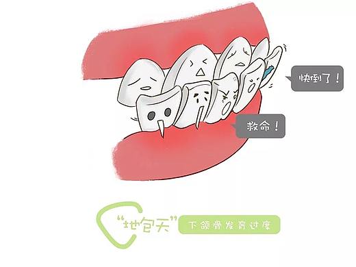 牙齿异常