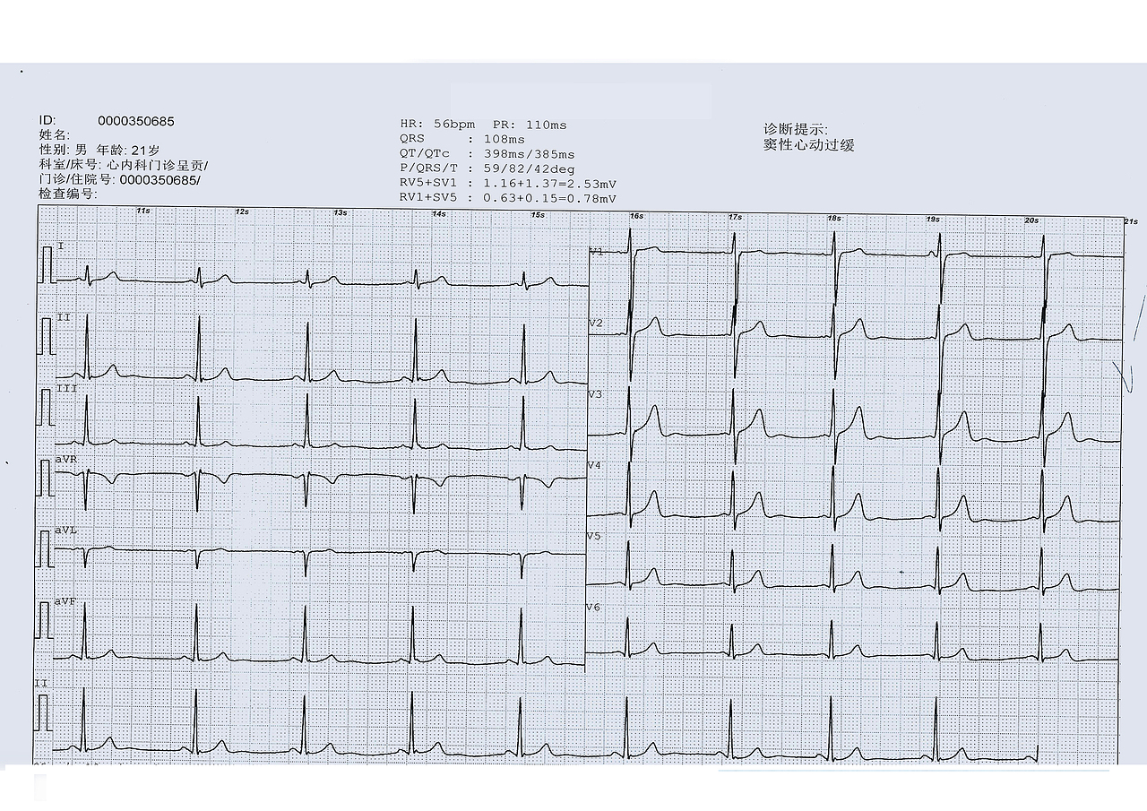 0000350685号生灵试验