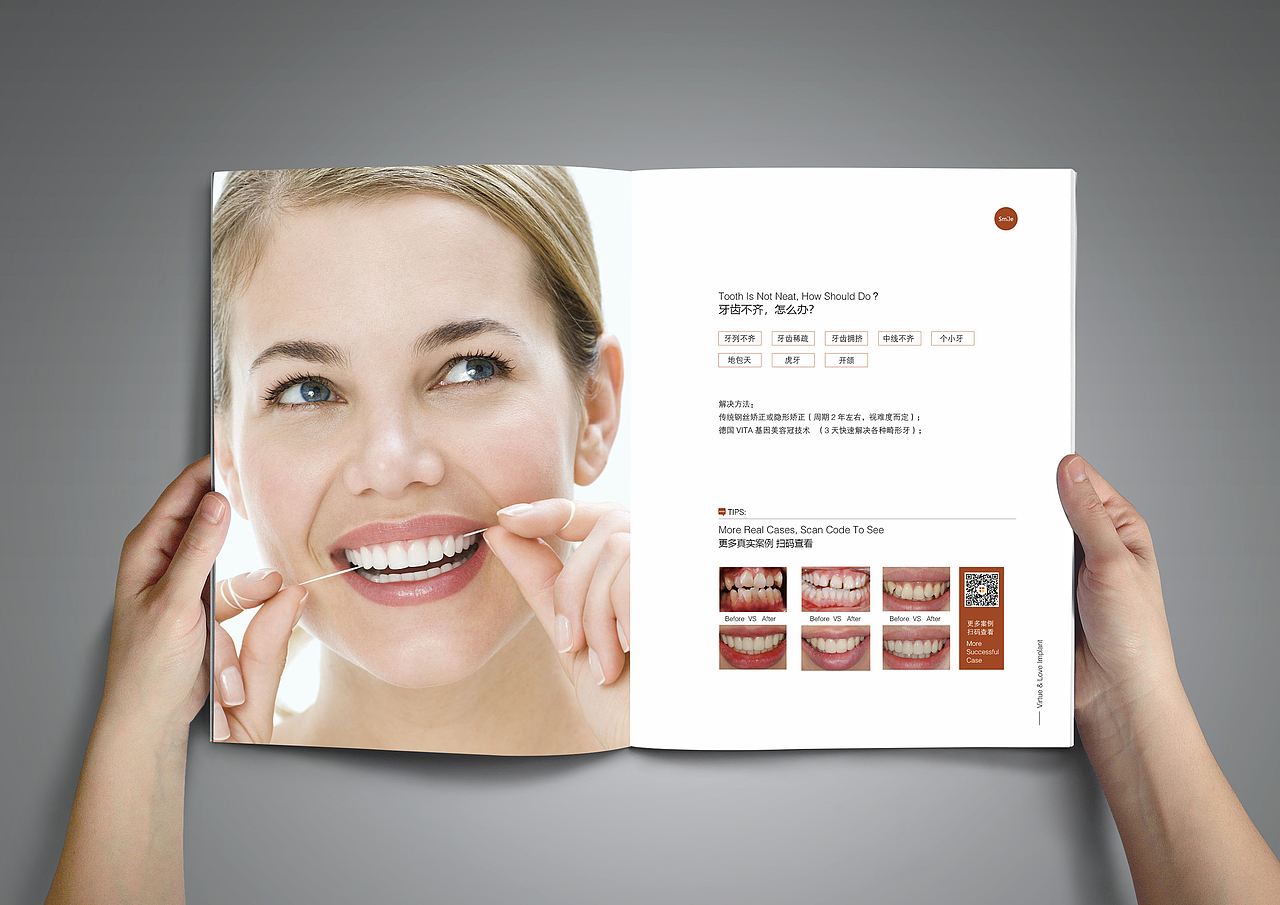 口腔画册手册品牌画册美牙画册牙贴面画册洁白牙