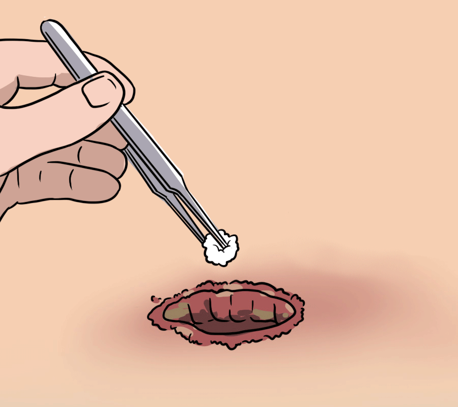 皮肤压力大就会“报废”？出现这些症状千万要当心！