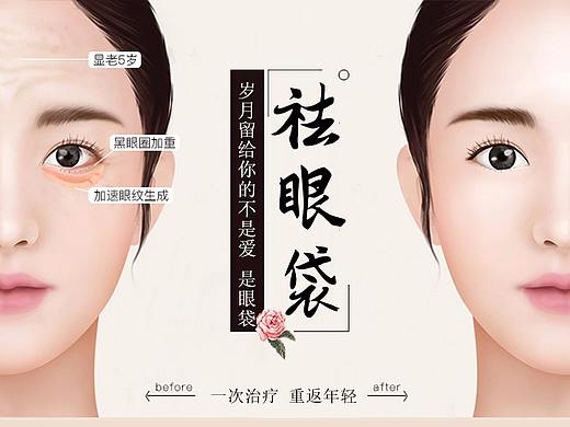 眼袋 眼袋整形专题 整形美容专题 医院专题  整形美容