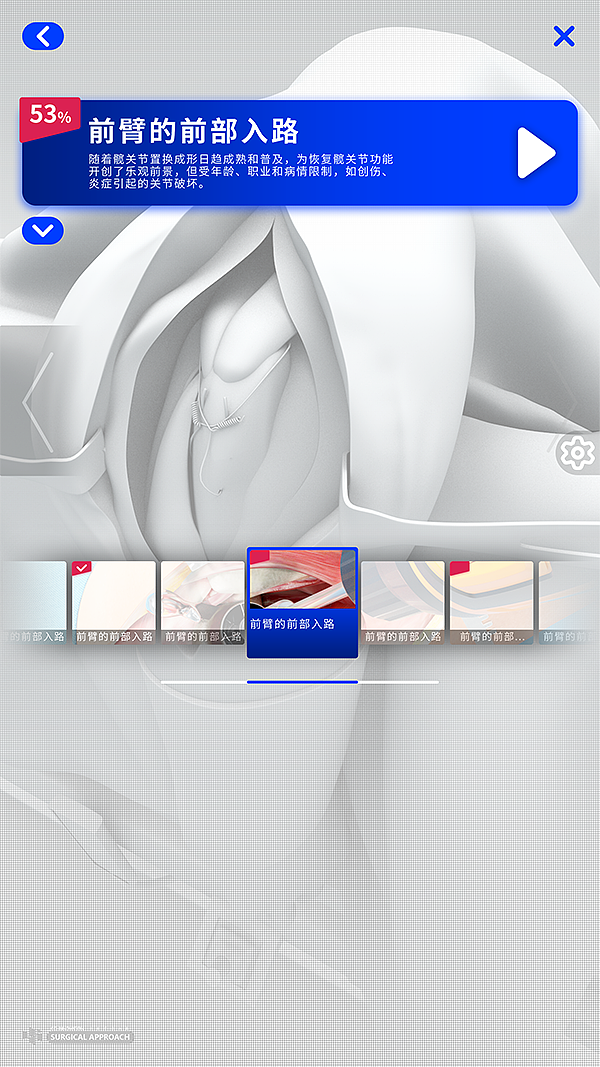 手術(shù)入路項目（圖ZMjMwNjE3MTI4） - 軟件界面 - 站酷設(shè)計師ivy129123原創(chuàng)素材 - 站酷ZCOOL