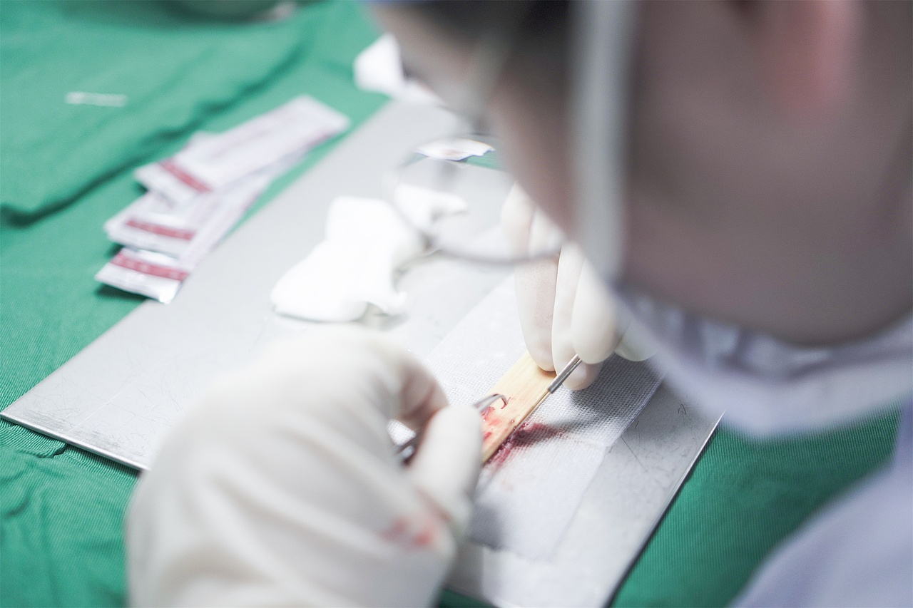 毛发种植医生术中纪实