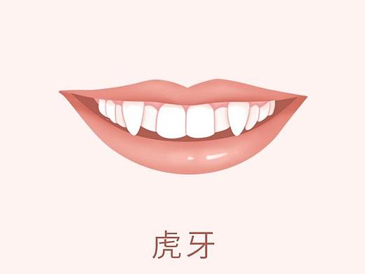 医美、口腔、牙齿牙齿矫正 牙齿不齐虎牙龅牙
